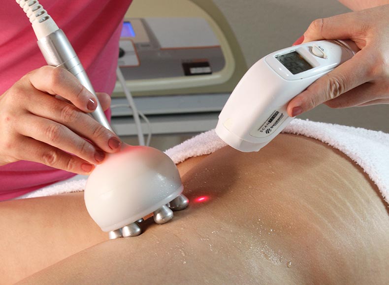 Tratamento Corporal - Radiofrequencia