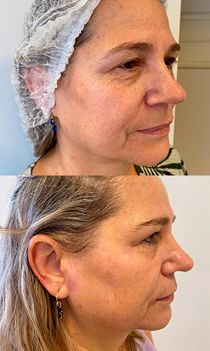 fotos-curso-ata-cs-simplestetica-academy-2