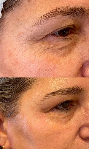 fotos-curso-ata-cs-simplestetica-academy